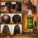 COMBO CAPILAR - SHAMPOO DE BATANA + ACEITE DE BATANA | TRATAMIENTO COMPLETO