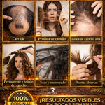 COMBO CAPILAR - SHAMPOO DE BATANA + ACEITE DE BATANA | TRATAMIENTO COMPLETO